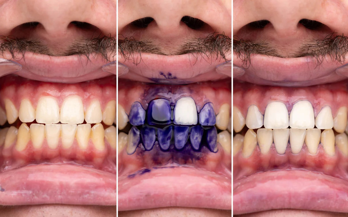 Balinanti dantų pasta OUHOE™