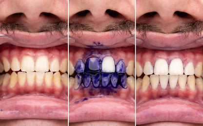 Balinanti dantų pasta OUHOE™